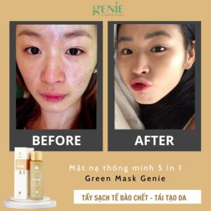review-mat-na-thong-minh-5-in1-genie
