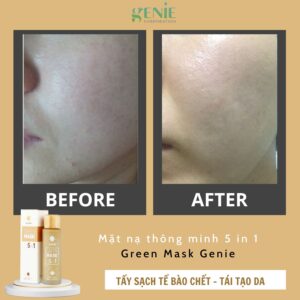 review-mat-na-thong-minh-5-in1-genie