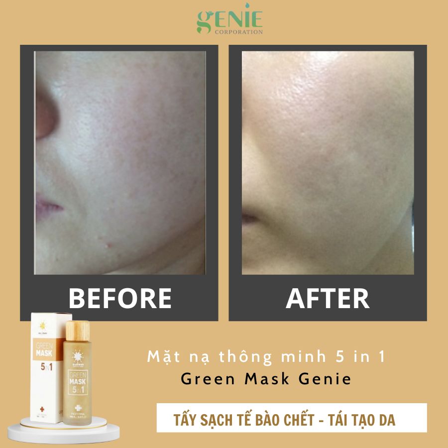 review-mat-na-thong-minh-5-in1-genie