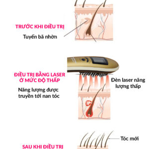 lược ánh sáng