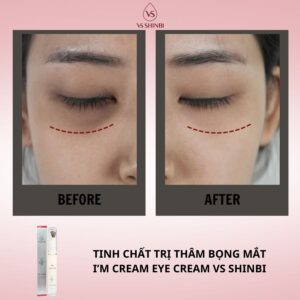 Tinh chất trị thâm bọng mắt I'm Cream Eye Cream VS SHINBI 15g - Ảnh 20