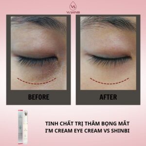 Tinh chất trị thâm bọng mắt I'm Cream Eye Cream VS SHINBI 15g - Ảnh 19
