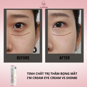 Tinh chất trị thâm bọng mắt I'm Cream Eye Cream VS SHINBI 15g - Ảnh 18