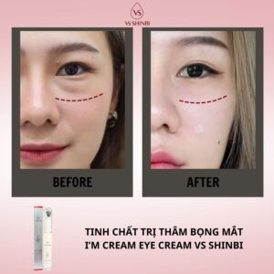 Tinh chất trị thâm bọng mắt I'm Cream Eye Cream VS SHINBI 15g - Ảnh 17